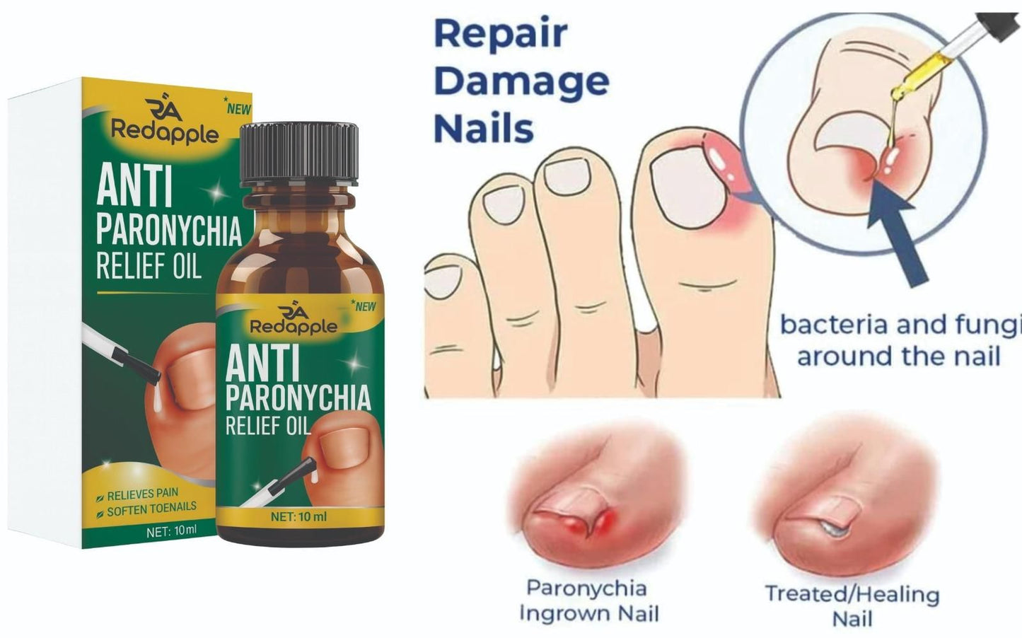 Anti Paronychia Relief Oil 20 ml Pack of 2